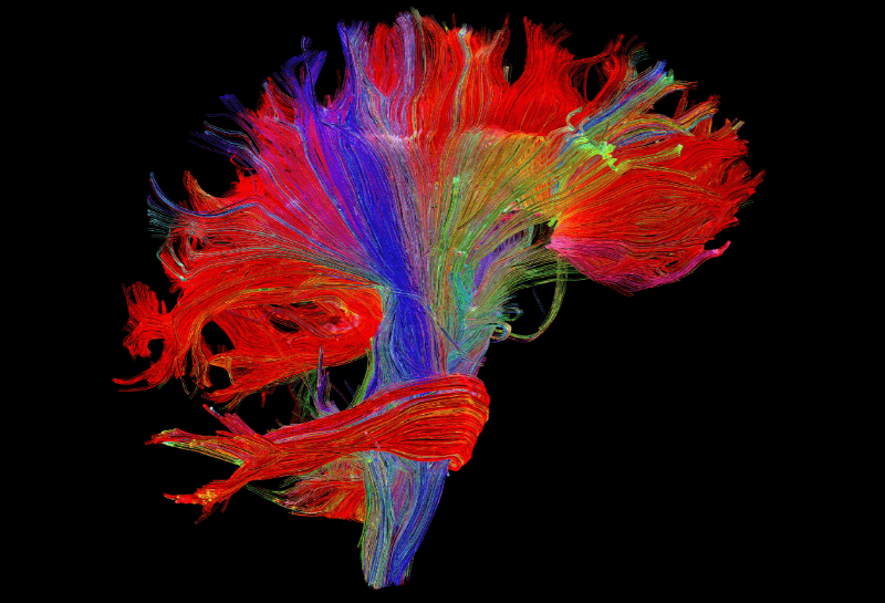 Neuroaesthetics: How Art Affects the Brain and Emotions
